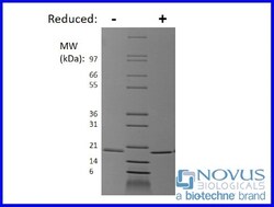 Novus Biologicals Recombinant Human IL-1ra/IL-1F3/IL1RN Protein 100 &mu;g | Buy Online | Novus Biologicals&trade; | Fisher Scientific